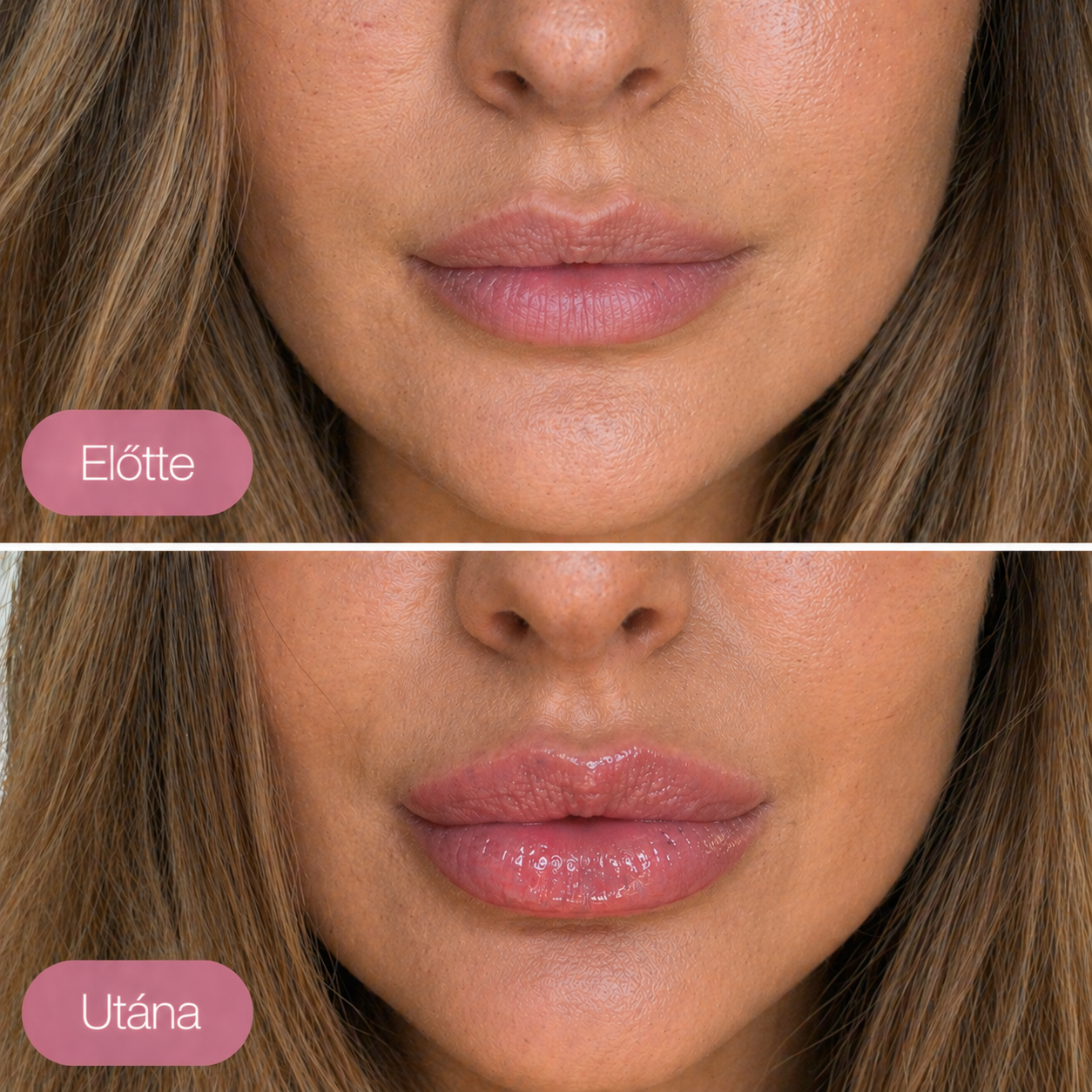 Nomoa® Ajaktelítő Gloss