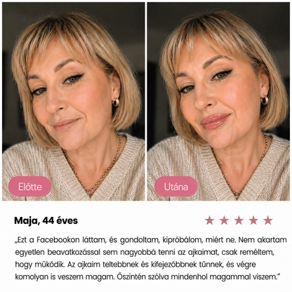 Nomoa® Ajaktelítő Gloss